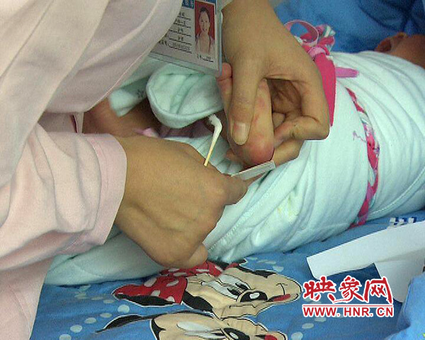 醫(yī)護(hù)人員在為一名新出生嬰兒采足跟血，做疾病篩查