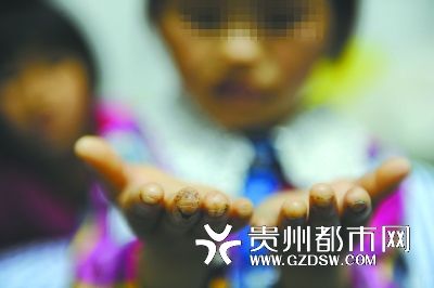 指尖被針扎得傷痕累累。