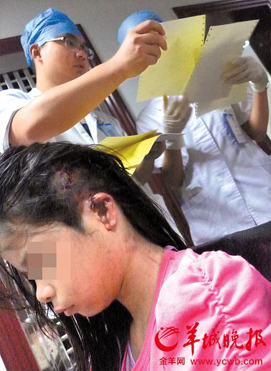 受傷的11歲女孩頭發(fā)被卷入扶梯，耳朵被嚴重拉傷，需手術。