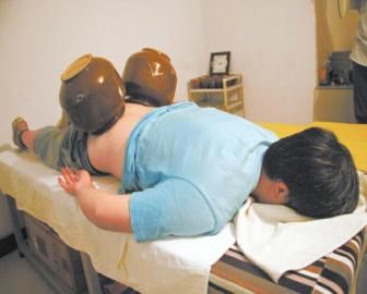 拔泡菜壇子火罐。