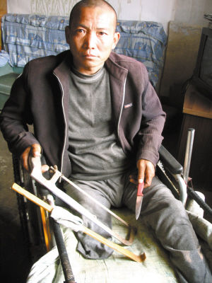 鄭艷良就是用這幾樣簡陋工具，給自己做了右腿截肢手術(shù)。