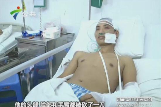 另一名傷者頭部、臉部和手臂都被砍了一刀。(視頻截圖)