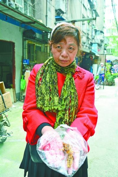 頭部受傷的黃女士展示兩根大魚刺。