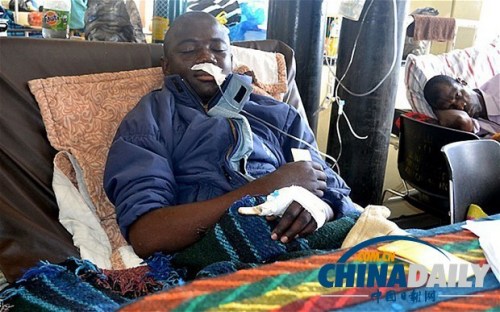 雖然已經(jīng)在醫(yī)院接受了近一個(gè)月的恢復(fù)治療，卡托卡的身體仍然非常虛弱。