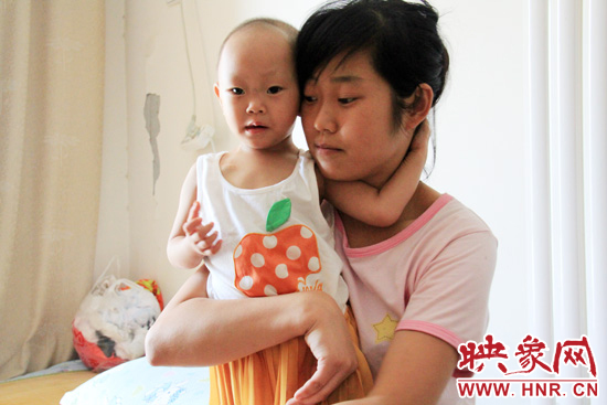 孩子和媽媽在一起，她的右眼已經失明。