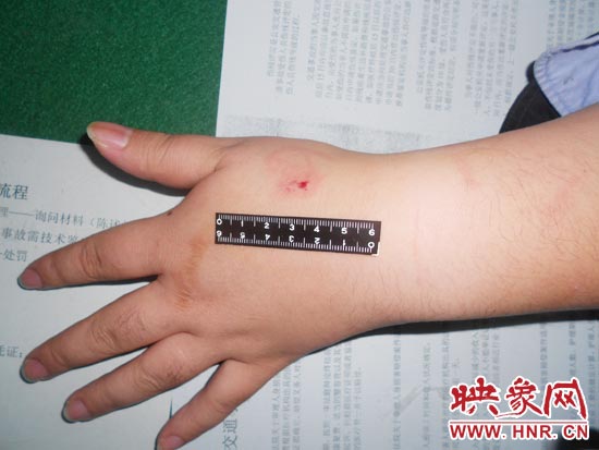 為幫助無(wú)證駕駛的朋友逃避處罰，新鄉(xiāng)的王某竟對(duì)執(zhí)勤民警大打出手，還將一名民警的手臂咬傷