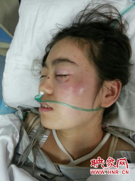 9月10日晚,被暴打的小陳出現(xiàn)了間歇性昏迷,被送進(jìn)了省人民醫(yī)院。