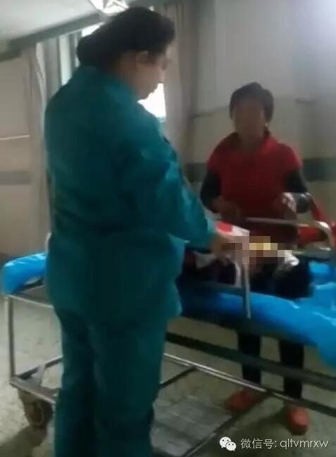 涵涵爸爸告訴《每日新聞》記者：“沒想到是熱水，大人也沒看，一時疏忽，掉進去了。抱出來的時候這個皮已經(jīng)掉了。”
