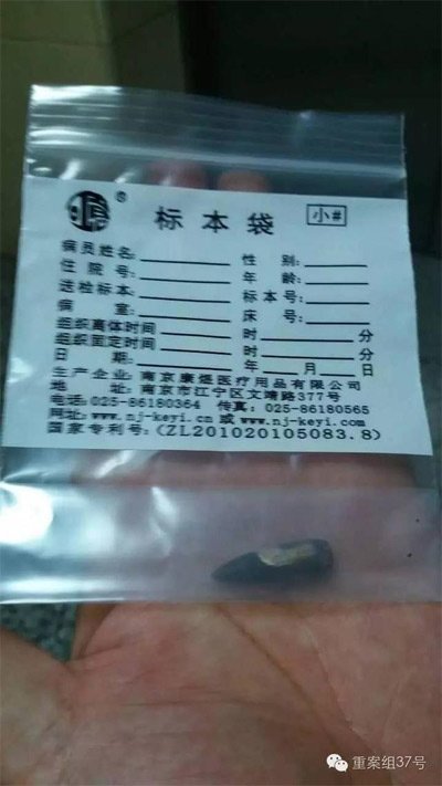 經(jīng)警方鑒定，秦女士體內(nèi)取出的子彈系56式步槍射出 。 受訪者供圖