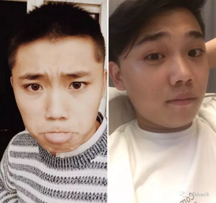 長胖20斤，臉型怎么變？這些例子看完扎心了！