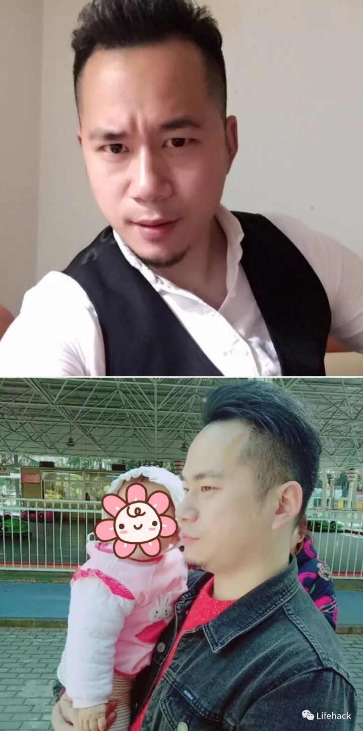 長胖20斤，臉型怎么變？這些例子看完扎心了！