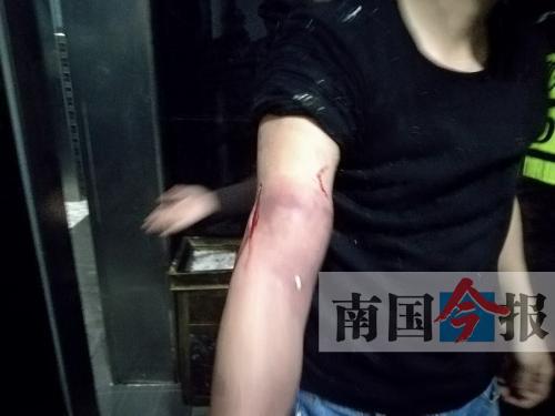 覃先生手臂被卡的部位受傷流血，所幸傷勢無大礙。 通訊員 王建民 攝