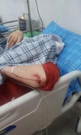 砸窗當(dāng)事人胡女士在醫(yī)院接受治療。