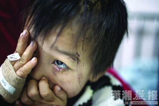 1月13日，湖南省兒童醫(yī)院，4歲的源源用手蒙住了眼睛。