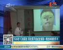 19小時 12名醫(yī)生 河北男子完成全球第一例自體換臉手術